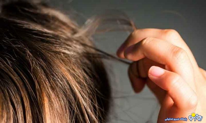 چرا برخی به کندن مو روی آورند؟